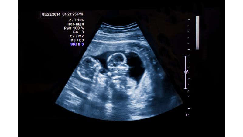 Ana Karnında Simetri