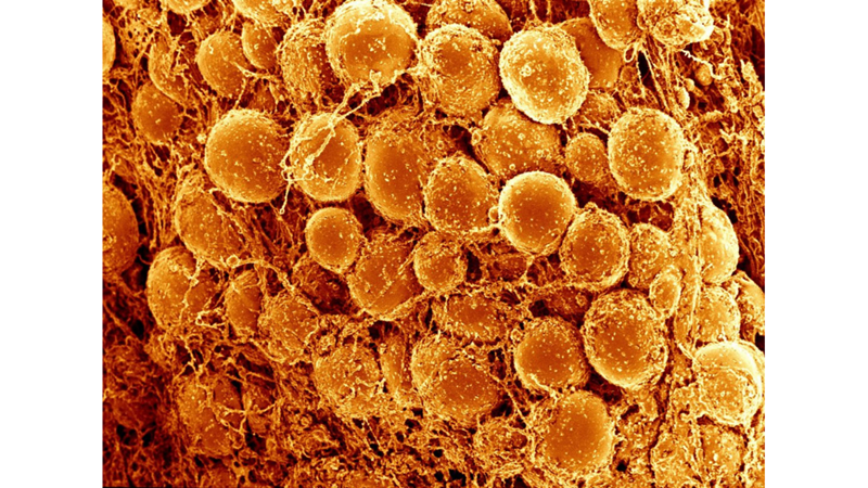 VÜCUDUMUZDA YAKTIĞIMIZ YAĞ KÜTLELERİ NEREYE GİDİYOR?