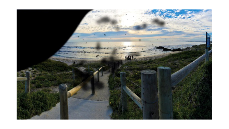 HOW DO PEOPLE WITH VISIONAL DISORDER SEE THE WORLD?